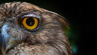 你真的了解激光近視手術(shù)嗎？