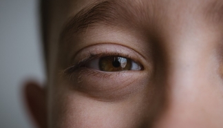 兒童患白內(nèi)障大多是由這些原因引起的